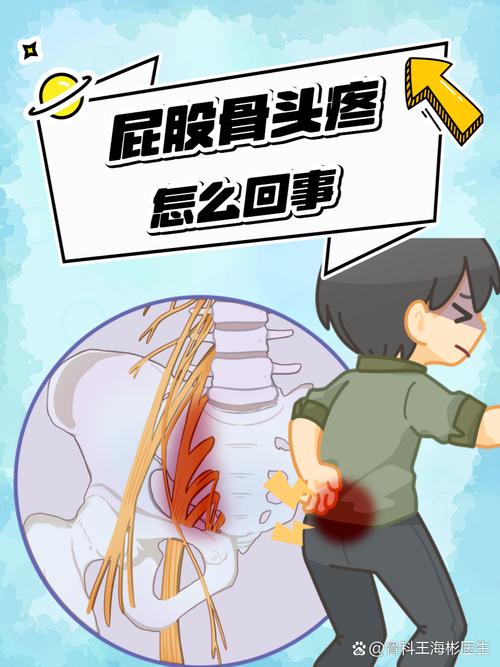 痛风会引起臀部疼痛吗