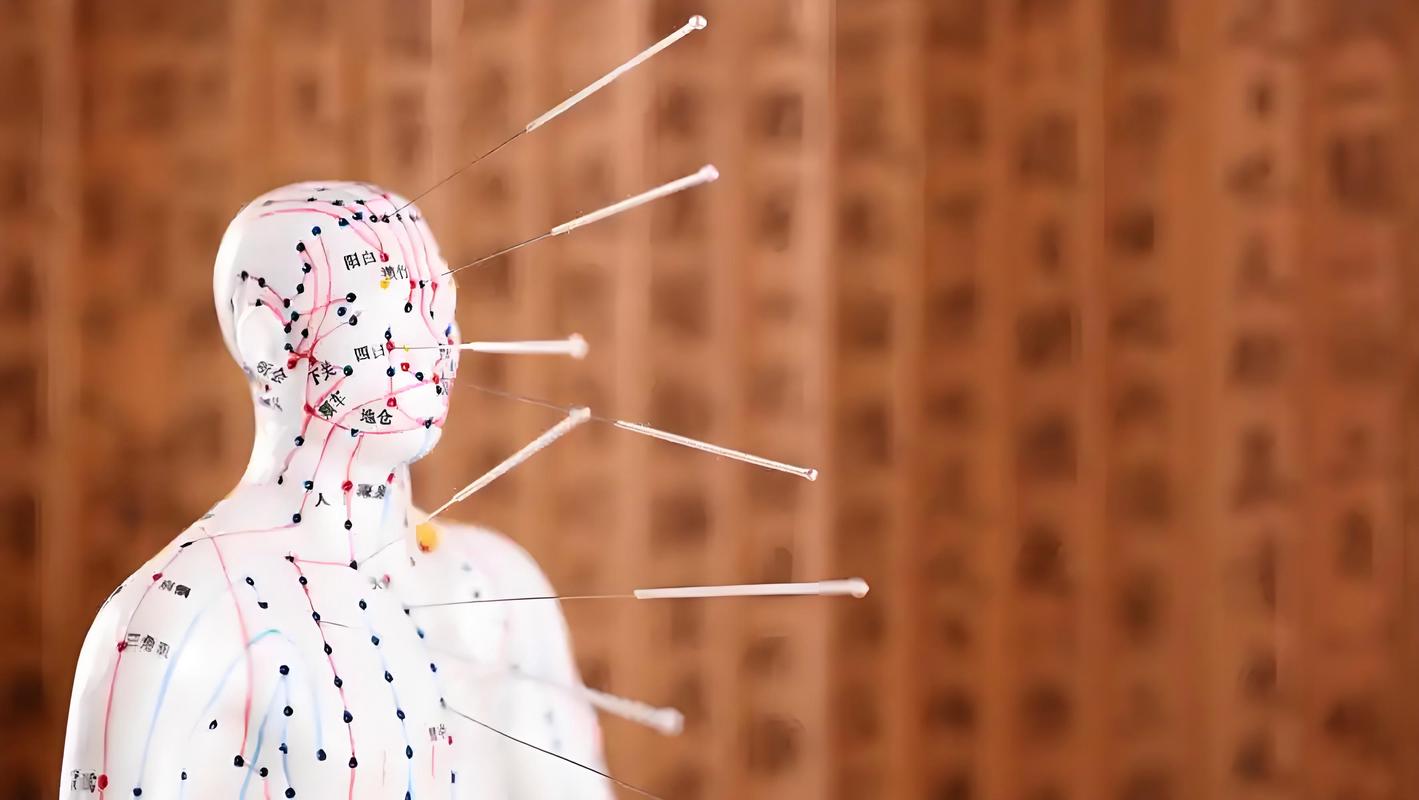 上海新医联门诊部针灸