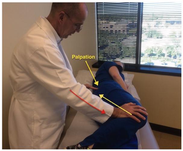 针灸治疗梨状肌综合症