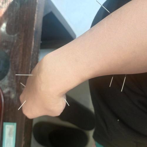 输卵管堵塞针灸能治吗