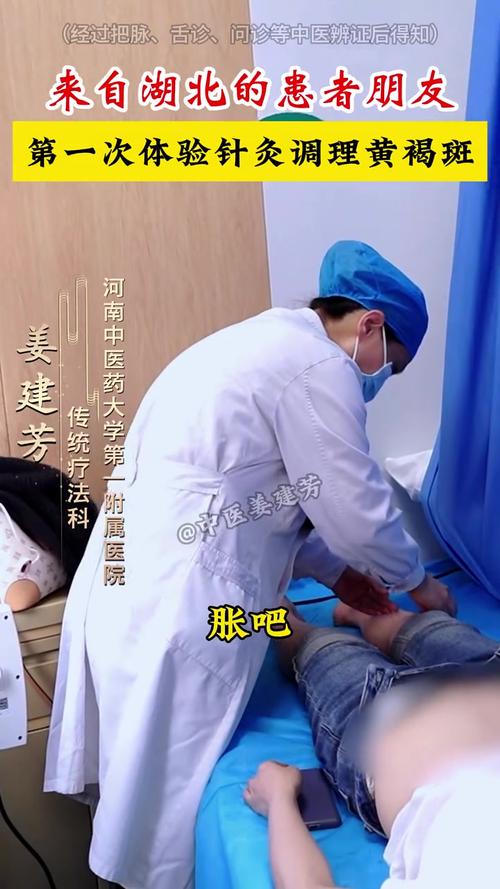 针灸治疗黄褐斑的效果