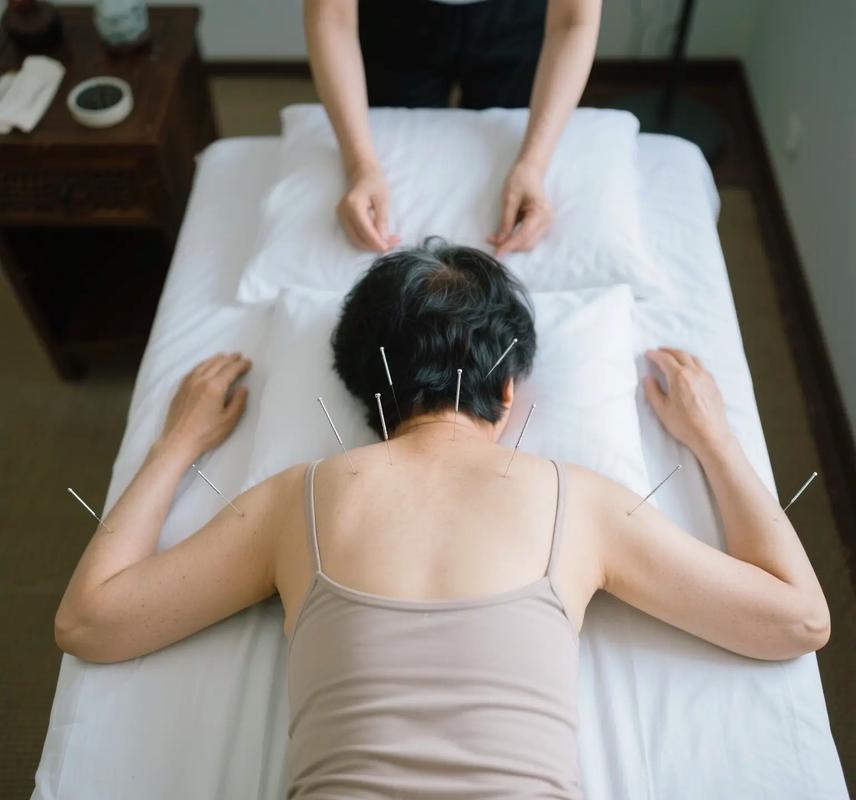 针灸治疗脊髓型颈椎病