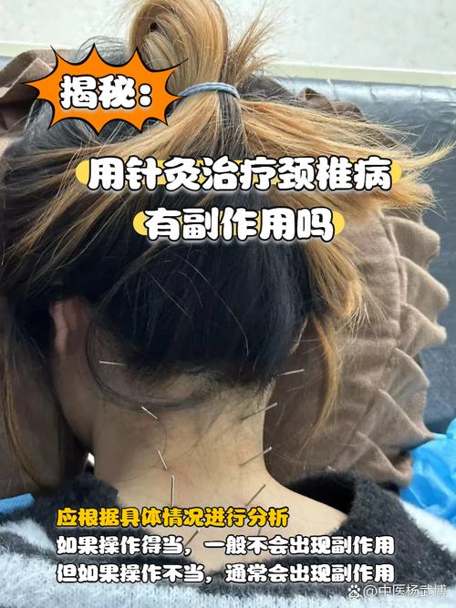 月经期可以颈椎针灸吗