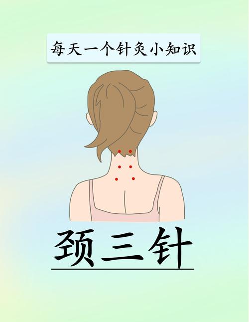 月经期可以颈椎针灸吗