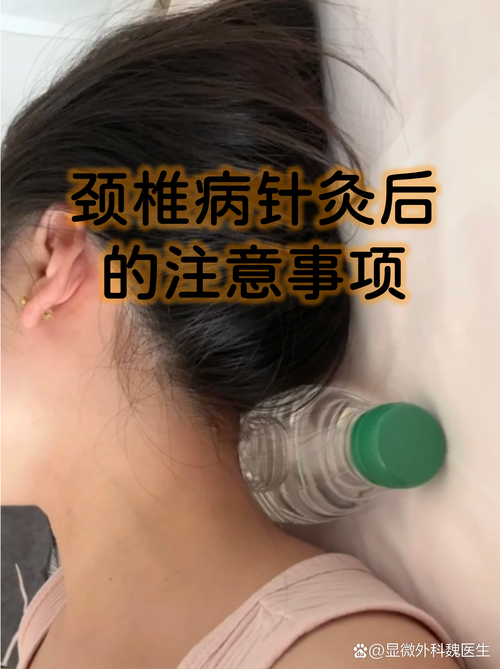 月经期可以颈椎针灸吗