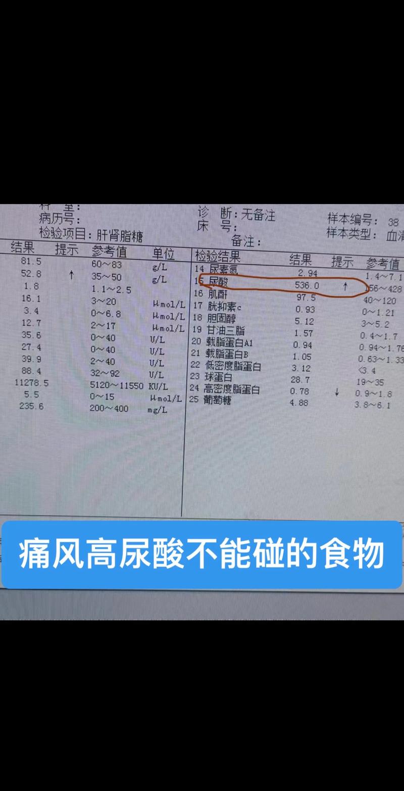 痛风肌肉疼痛肌酶升高