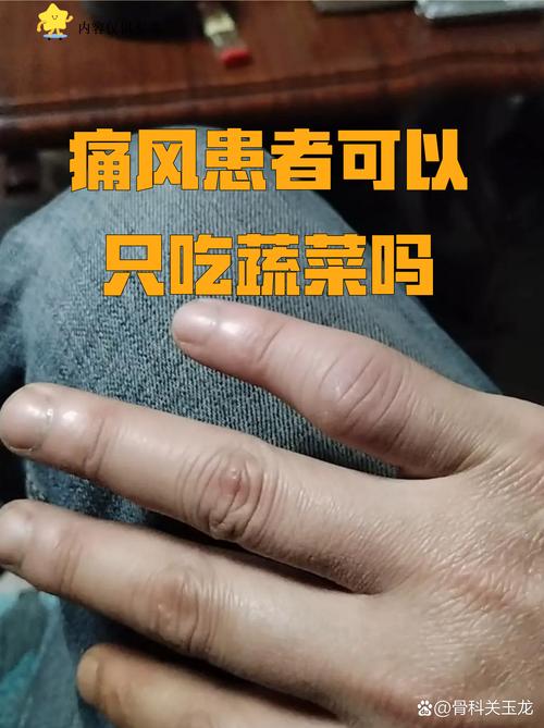 痛风患者可以吃驴肉吗