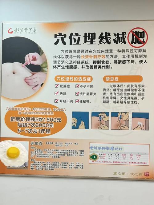 针灸埋线减肥有效果吗