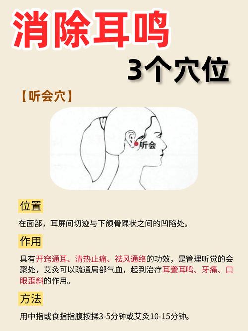 神经性耳鸣针灸要多久