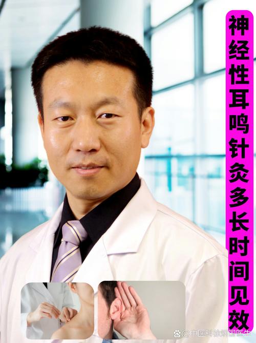 神经性耳鸣针灸要多久