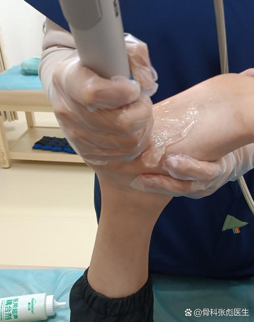 足跟骨刺针灸怎么治疗