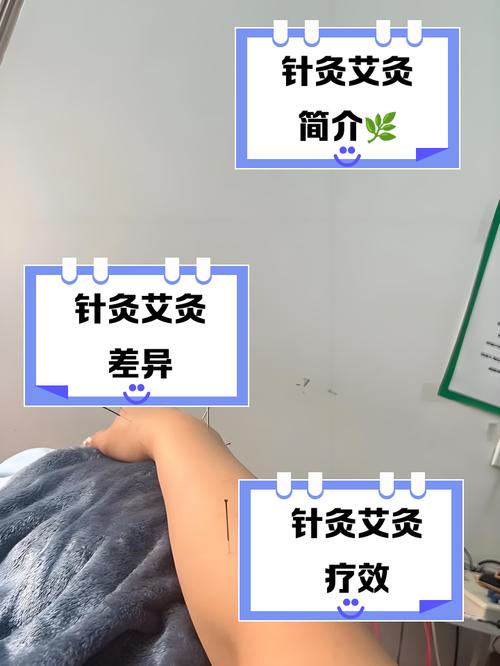 针灸和艾灸有什么区别