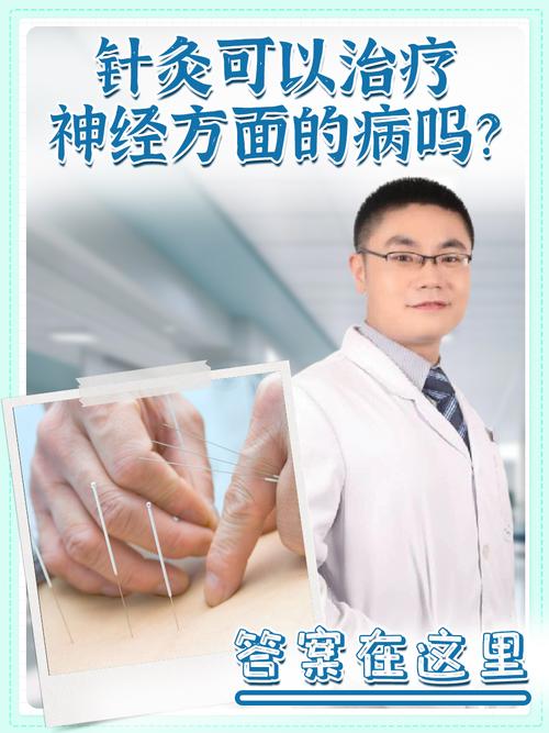 针灸能治疗小脑萎缩吗