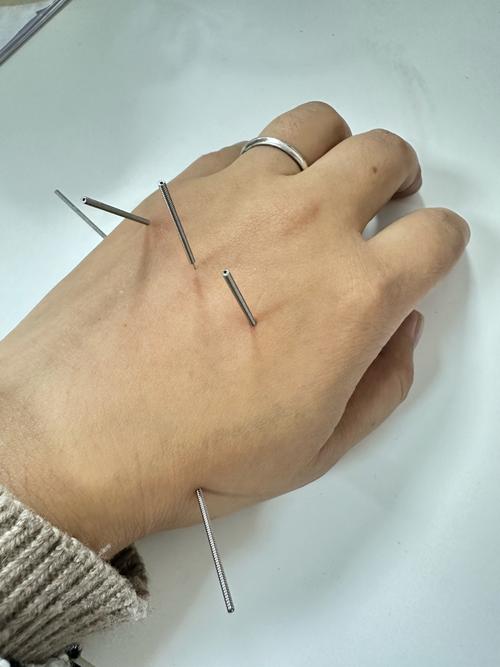 被病人用过的针灸针扎