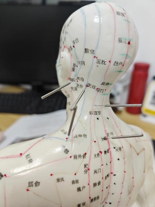 植物神经紊乱针灸穴位