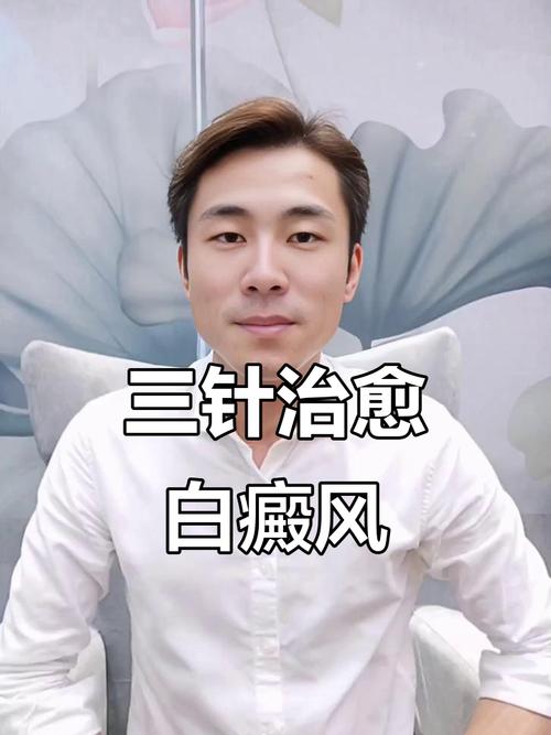 针灸治疗白斑有效果吗