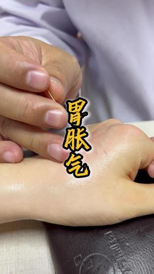 针灸治疗胃肠功能紊乱