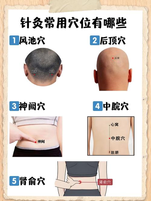 国家针灸穴位取穴标准