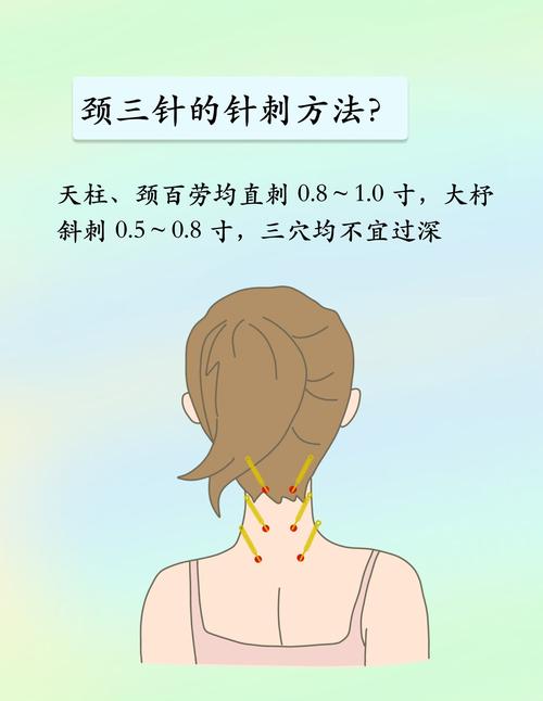 来月经颈椎可以针灸吗