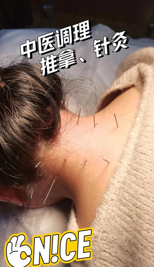 来月经颈椎可以针灸吗