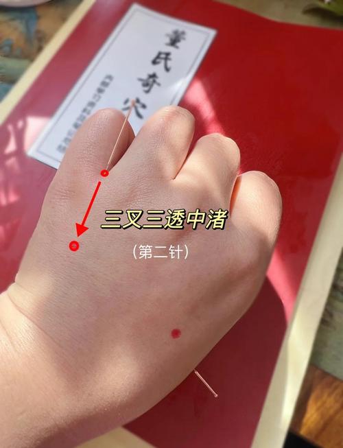 针灸后的针眼多久闭合