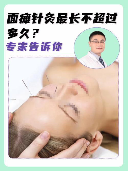 面瘫针灸最佳治疗时间