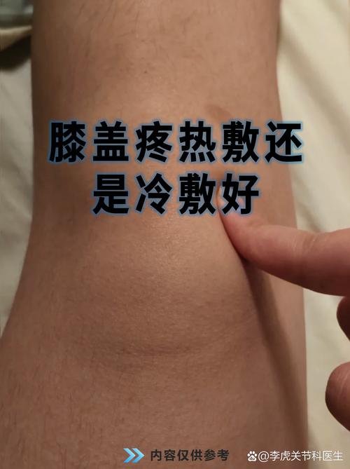 治膝盖痛风最好的方法