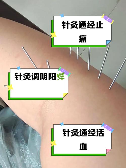 髋关节滑膜炎能针灸吗