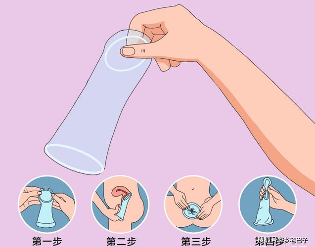 安全避孕的方法有哪些