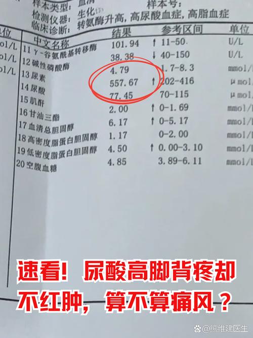 尿酸值多高多少算痛风