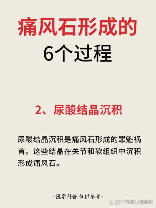 痛风形成的原因有哪些