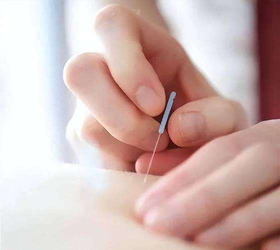 强直性脊柱炎能针灸吗