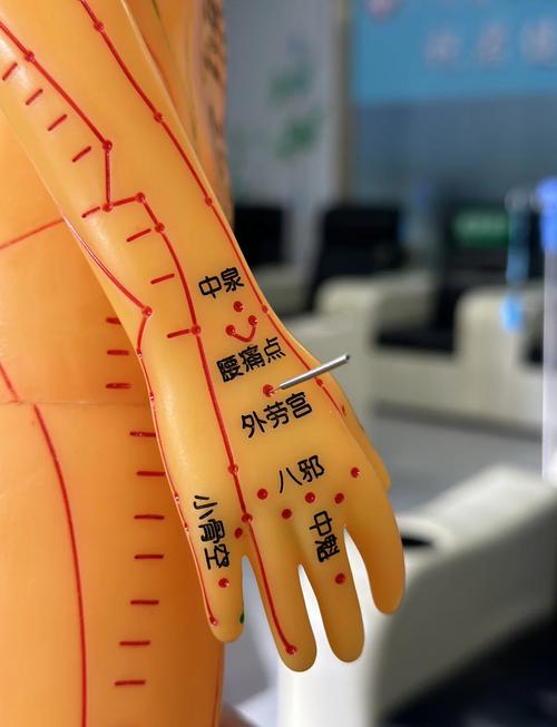 脑供血不足可以针灸吗