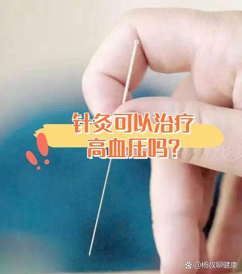 高血压心脏病能针灸吗