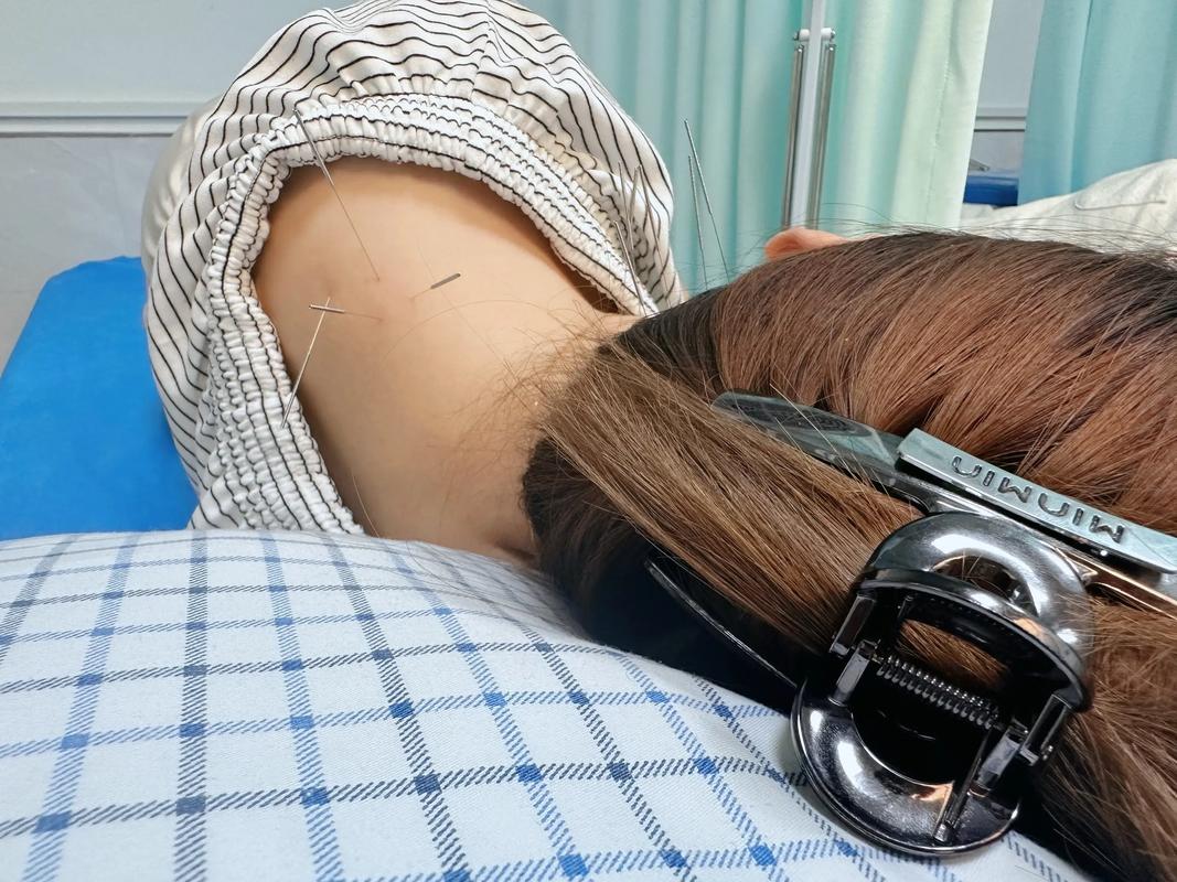 飞机上可以带针灸针吗