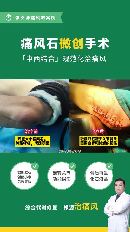 北京什么医院看痛风好