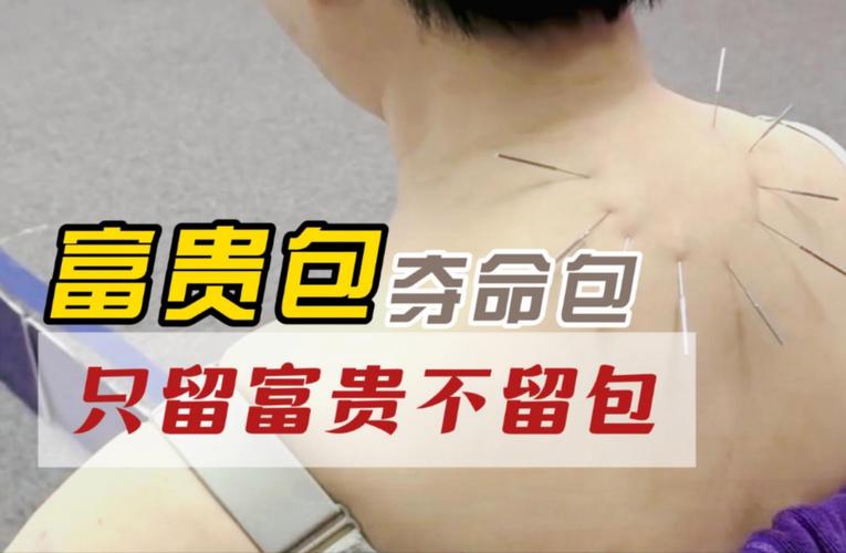 针灸可以去掉富贵包吗