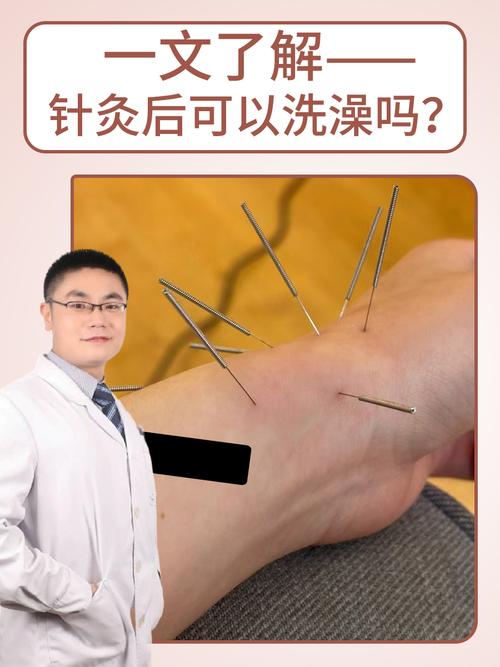 针灸后为什么不能洗澡