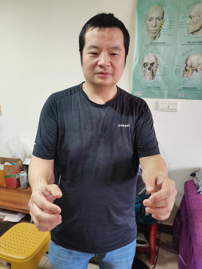 北京鼓楼中医医院针灸