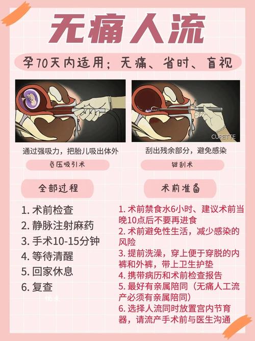 哪个医院无痛流产安全