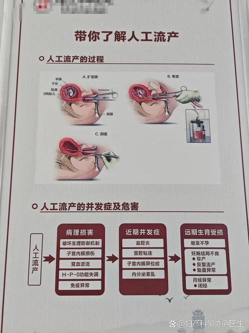 哪个无痛流产医院安全