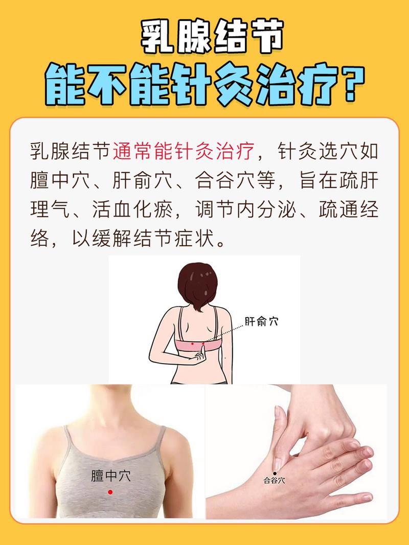 针灸6天乳腺结节没了