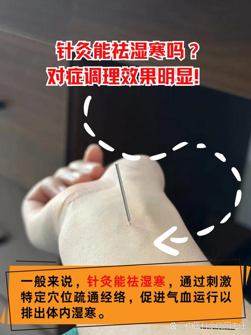 针灸可以降低FSH吗