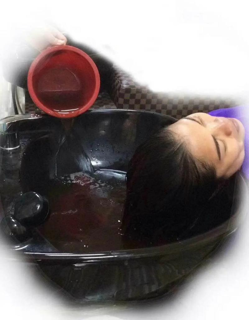 针灸头部后可以洗头吗