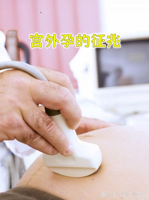 宫外孕包块可以针灸吗