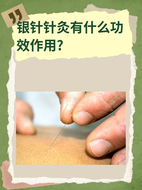 针灸会有什么副作用吗