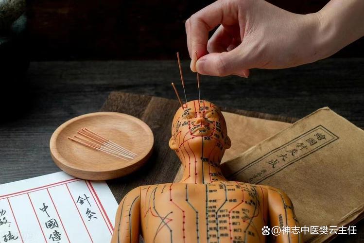 针灸治疗抑郁需要多久