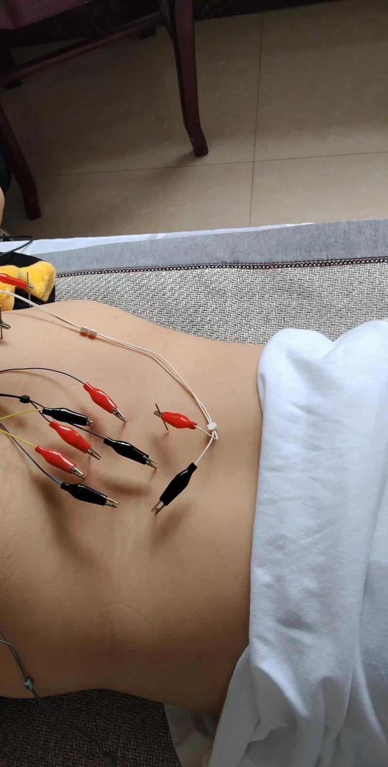 康复治疗考研针灸推拿