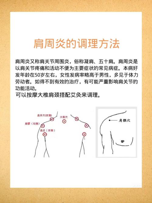 针灸治疗肩周炎的优势