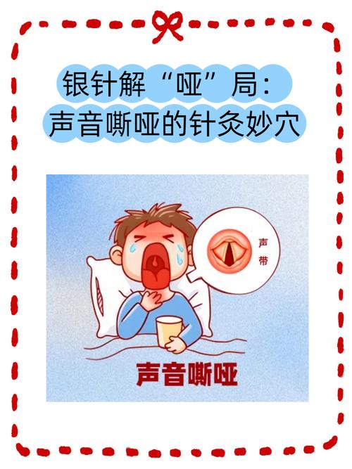 嗓子发炎针灸什么位置